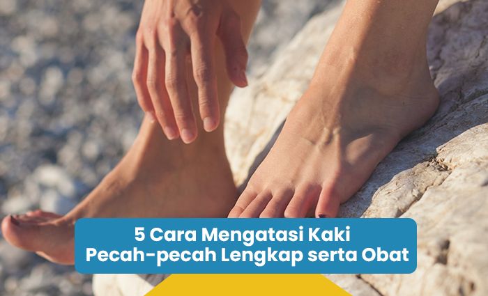 Cara Mengatasi Kaki Pecah Pecah Lengkap Beserta Obatnya Riotallo